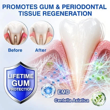 GRUNSIFY periodontal tissue product illustration