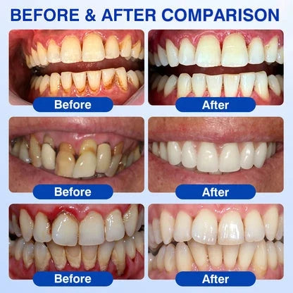 🧑‍⚕️GRUNSIFY Periodontal Care Gel