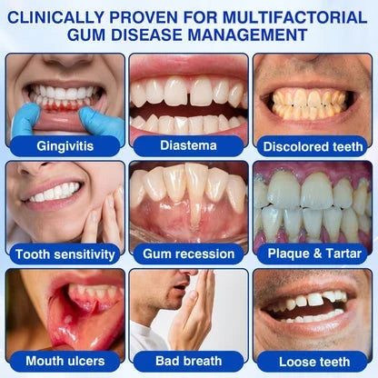🧑‍⚕️GRUNSIFY Periodontal Care Gel