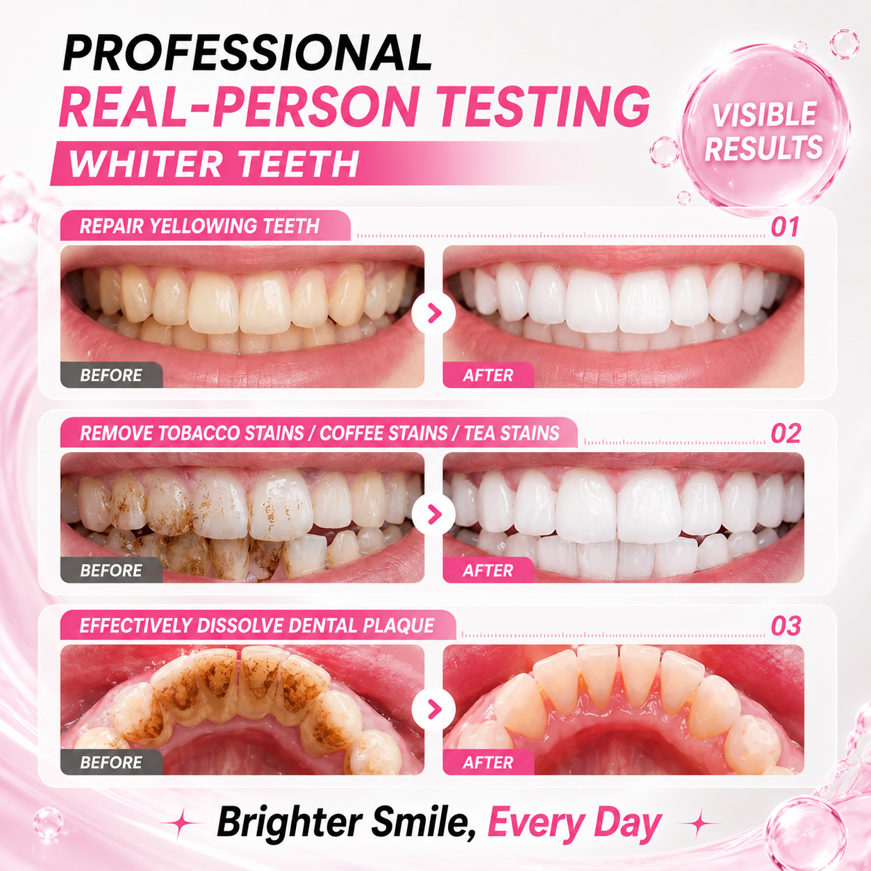 🏆Best Sale🔥Tooth Shield Fluoride Free Toothpaste Serum