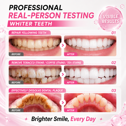 🏆Best Sale🔥Tooth Shield Fluoride Free Toothpaste Serum