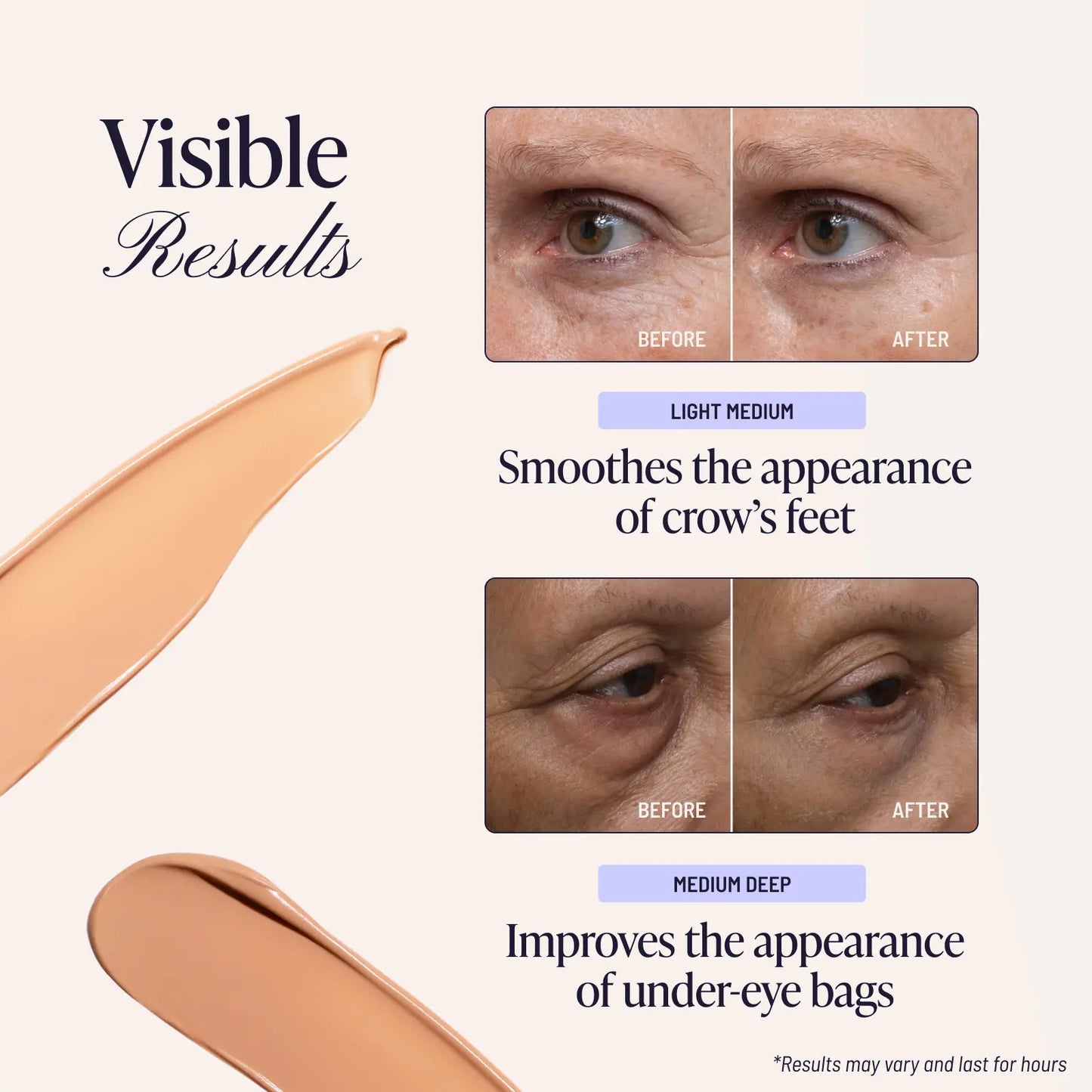 🪄AQA FIRM & CONCEAL EYE CREAM（2-Pack）