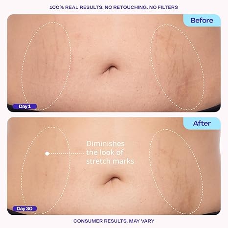Brand supplied before and after thirty days example