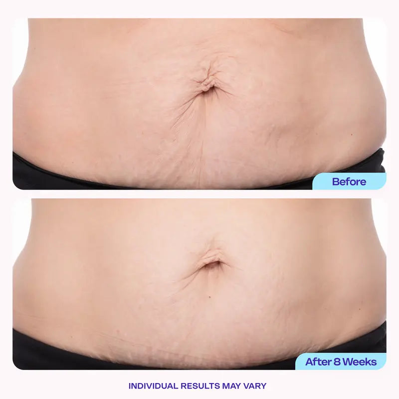 Brand supplied before and after eight weeks example