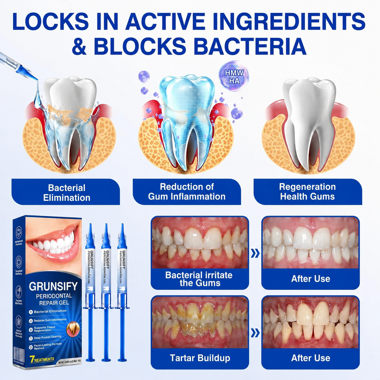 🧑‍⚕️GRUNSIFY Periodontal Care Gel